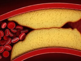 Nová pilulka na snížení cholesterolu od společnosti Merck jde do prodeje